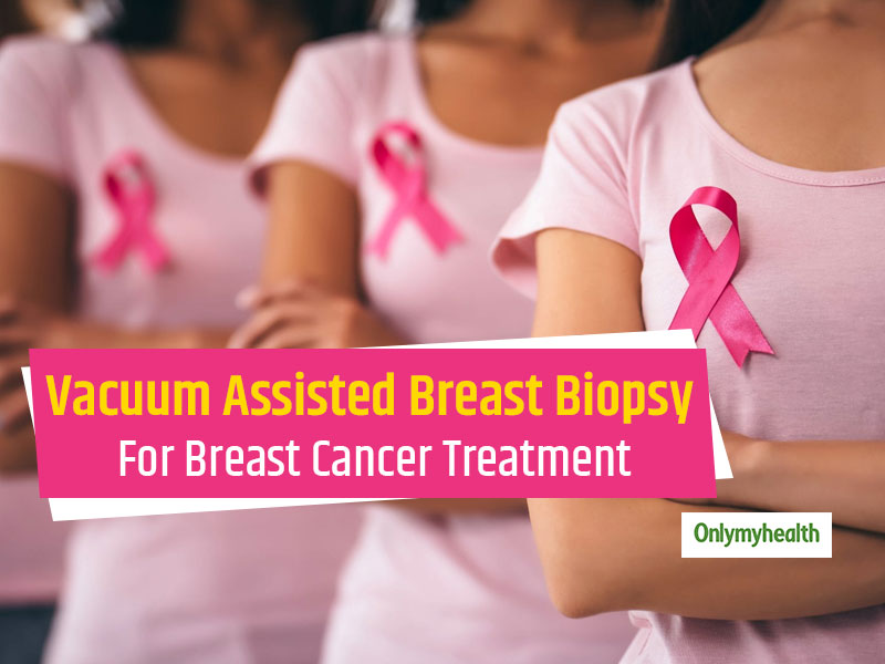 Breast Cancer Awareness Month: Vacuum-Assisted Breast Biopsy For Minimum Invasive Detection And Treatment